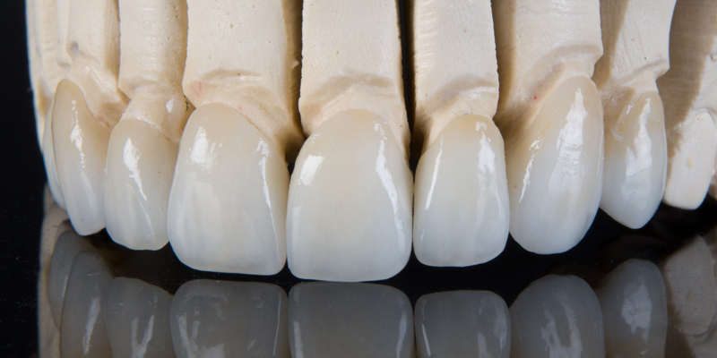 Zirkonzahn Ceramics at PERFECT SMILE Dental Clinic